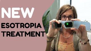 New Treatment For Esotropia [upl. by Stephana929]