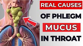 The Real Causes of Constant PHLEGM amp MUCUS In Your Throat [upl. by Rennane]