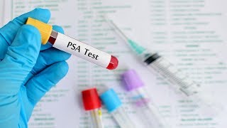 Taux de PSA dans le sang Antigène prostatique spécifique [upl. by Schulze]