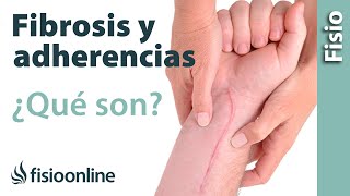 Fibrosis y adherencias en lesiones y heridas  Qué es causas e importancia [upl. by Tuneberg621]