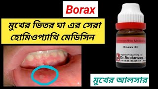 Borax Homeopathic Dava । Mouth Ulcer Treatment । [upl. by Dwinnell]