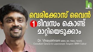 വെരികോസ് വൈൻ മാറ്റാൻ 2 വഴികൾ  varicose veins malayalam health tips [upl. by Adama]