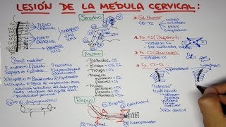 Lesión de la médula cervical  trauma vertebro medular [upl. by Arekat]