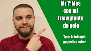 Mi 1º mes con mi trasplante de pelo Información cómo dormir prohibiciones y consejos [upl. by Rieth]