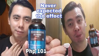 3 CORRECT TIPS HOW TO USE POVIDONE IODINE BETADINE GARGLE FOR SORE THROAT RELIEF  HONEST REVIEW [upl. by Nylidam773]