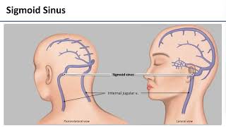 LO6 Dural Venous Sinuses [upl. by Atinaw]