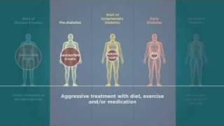 Beta Cells in Type 2 Diabetes [upl. by Pascale]