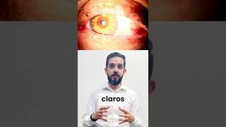 Heterocromia de iris personas con ojos de diferente color [upl. by Ko]