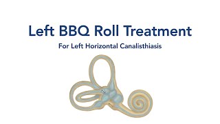 At Home Left BBQ Roll Treatment for BPPV Vertigo [upl. by Smitty519]