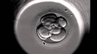 ivf embryo developing over 5 days by fertility Dr Raewyn Teirney [upl. by Lananna]