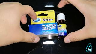 Scholl Verucca Removal Gel Review [upl. by Crispas992]