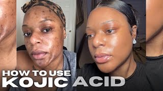 HOW TO USE KOJIC ACID SOAP WATCH THIS BEFORE USING KOJIC ACID [upl. by Aihsitan]