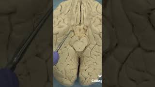 Medial temporal lobe parahippocampal gyrus neuroanatomy temporallobecortexlimbic system [upl. by Ahsaten625]