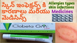 Allergy and Skin Infections with Clobeta Gm Ointment in allopathic in Telugu Tamara in Telugurings [upl. by Kristy]