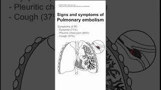 Signs and symptoms of Pulmonary embolism [upl. by Fink190]