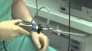 Arthroscopy Basics in Orthopaedics [upl. by Furmark832]