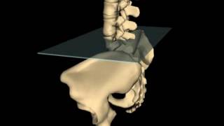 Posterior Innominate Rotation [upl. by Teressa]