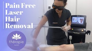 Pain Free Laser Hair Removal  Thérapie Clinic [upl. by Maddocks]