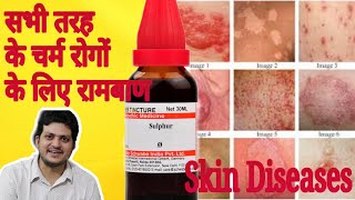 Sulphur Mother Tincture ko kaun kaun si skin disease चर्म रोग में use Karen aur kaise use Karen [upl. by Annodal533]