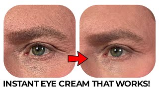 THE INSTANT EYE CREAM THAT WORKS IMMEDIATELY [upl. by Katherine]