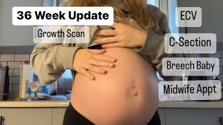 36 Week Pregnancy Update  Breech Baby Growth Scan CSection [upl. by Rachaba917]