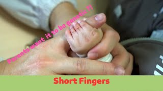 Brachydactyly  Baby Had Short Fingers Mother Wanted it to Be Genetic [upl. by Mcgean]