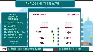 ECG FAST TRACK part 19 normal coronary perfusion [upl. by Dellora]