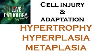 Cell Adaptations pathologyHYPERTROPHY HYPERPLASIA AND METAPLASIA [upl. by Innos]