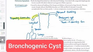 Bronchogenic Cyst Respiratory System 4  First Aid USMLE Step 1 in UrduHindi [upl. by Eisse]