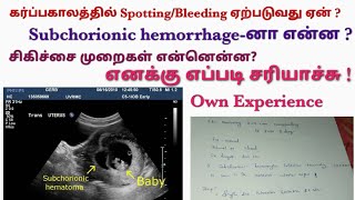 SpottingampBleeding during Early PregnancySubchorionic Hemorrhage in tamilhow I overcomeyashoslife [upl. by Chastain]