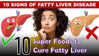 Home Remedies  Fatty Liver Treatment  10 Super Foods To Combat Fatty Liver [upl. by Candyce78]