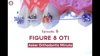 Figure 8 Oti Asker Orthodontic Minute Episode 6 [upl. by Elocyn]