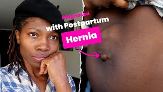 Suffering From UMBILICAL Hernia Postpartum Hernia After Pregnancy Waiting For Surgery [upl. by Anilejna]