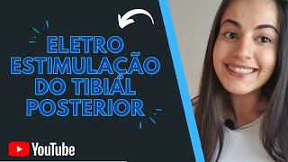 Eletroestimulação do nervo tibial posterior para inibição da bexiga hiperativa [upl. by Pogah390]