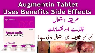 How To Use Augmentin 625mg Tablets Used For In Urdu  Side Effects [upl. by Latouche]