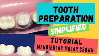 Zirconia Crown Preparation DEMONSTRATION Super Simplified [upl. by Siwel]