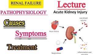 Renal failureAcute Renal failureChronic Renal Failuremedicine lecture renalfailure renaldisease [upl. by Juley]