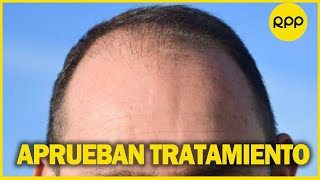 ALOPECIA EEUU aprueba el primer medicamento contra la enfermedad que provoca caída de cabello [upl. by Nayd]