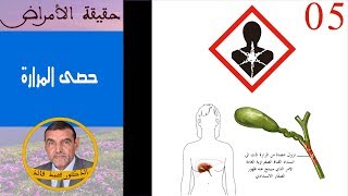 حقيقة حصى المرارة  الدكتور محمد فائد [upl. by Adrial]