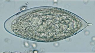 Schistosoma Haematobium [upl. by Adiuqram]