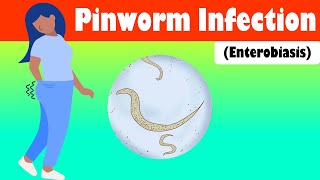 Pinworm Infection Enterobiasis  Causes Signs amp Symptoms Treatment [upl. by Alethia247]