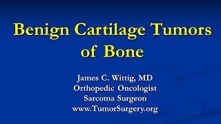 Orthopedic Oncology Course  Benign Cartilage Tumors Osteochondroma Chondroblastoma  Lecture 5 [upl. by Vilhelmina949]