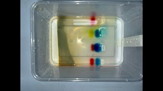 HL2 GROUP 2Gel ElectrophoresisDIY20242025 [upl. by Reggis335]