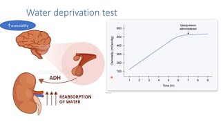 USMLE Step 1 Diabetes Insipidus vs Psychogenic polydipsia water deprivation test [upl. by Yrevi47]