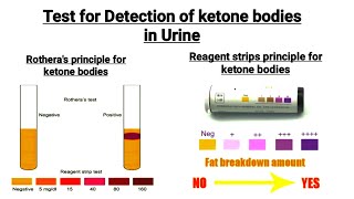 Chemical Examination of urine  Detection of ketone bodies in urine  Reagent strip  Rotheras Test [upl. by Padraig990]