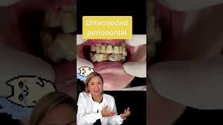 La enfermedad periodontal no solo afecta tus encías también pone en riesgo tus dientes [upl. by Raoul]