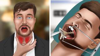 ASMR Animation Remove fish bones stuck in MrBeasts throat [upl. by Megdal]