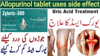 zyloric tablet uses in urdu  Allopurinol tablet  zyloric 300 mg tablets  zyloric tablet [upl. by Aliuqahs575]