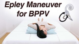 Epley Maneuver to Treat BPPV Dizziness with DixHallpike to Determine Which Side [upl. by Annawad]