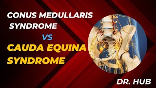 Conus medullaris syndrome vs cauda equina syndrome [upl. by Annaira70]